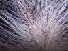 Can gray hair be reversed? Science answers
